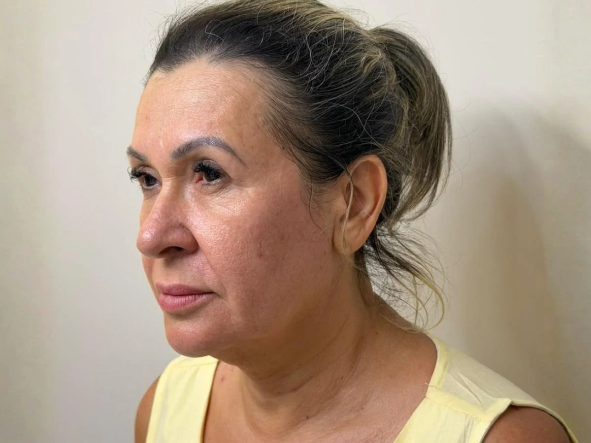 Antes Protocolo Elleve